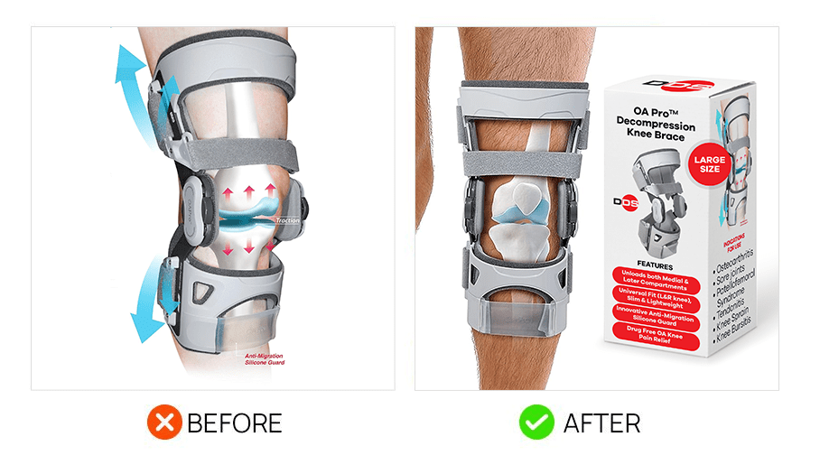 Before and after images showcasing the effectiveness of a knee brace.