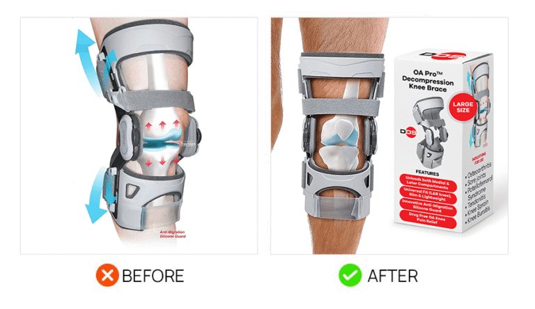 Main Image CTR Upgrade 11 Knee brace product using the Amazon main image hack